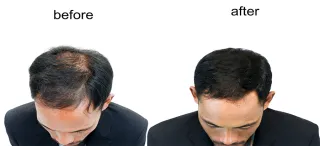 Ausbildung Hairline - Microblading